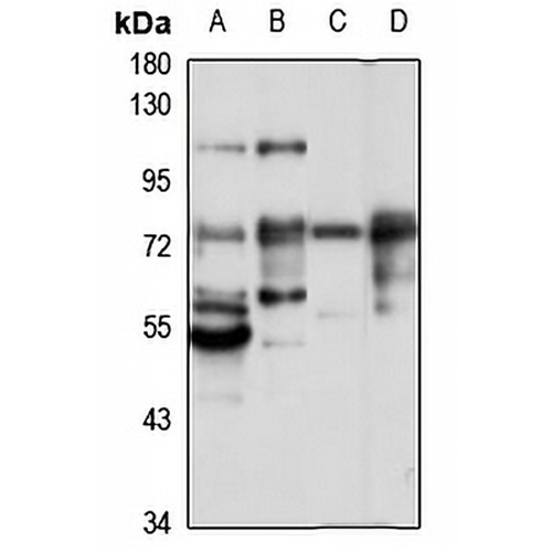 GRK4 Rabbit Polyclonal Antibody