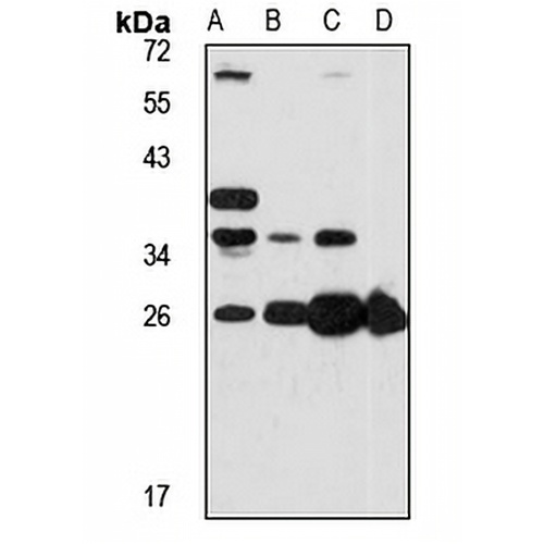 GSTA3 Rabbit Polyclonal Antibody