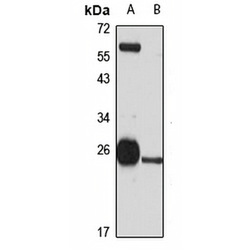 GSTM3 Rabbit Polyclonal Antibody