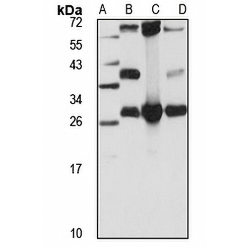 GSTT2 Rabbit Polyclonal Antibody