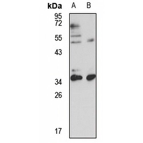 TFIIB Rabbit Polyclonal Antibody