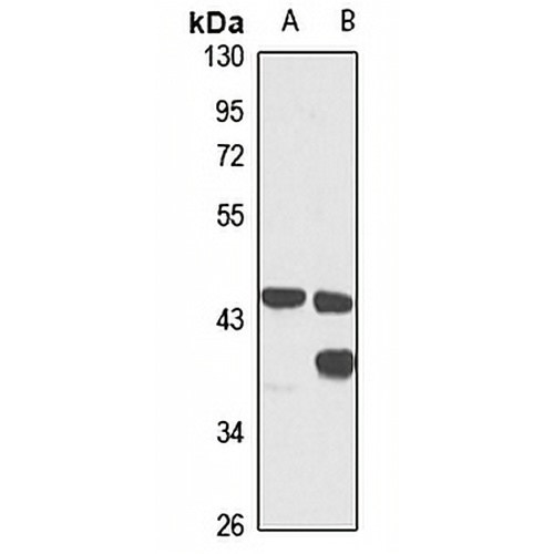 GTF2H2 Rabbit Polyclonal Antibody