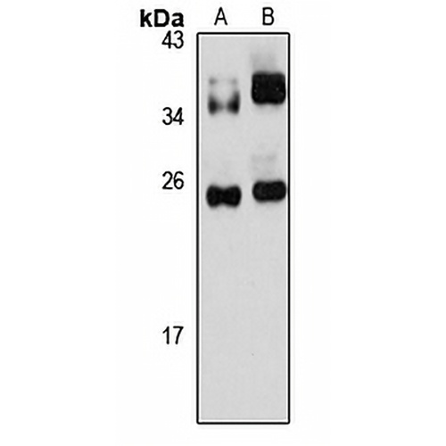 TFIIIC35 Rabbit Polyclonal Antibody