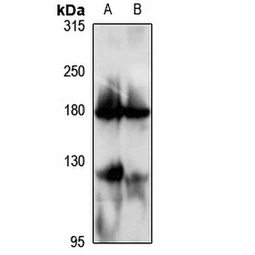 GC-C Rabbit Polyclonal Antibody