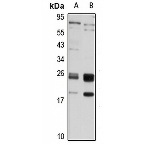 GUK1 Rabbit Polyclonal Antibody