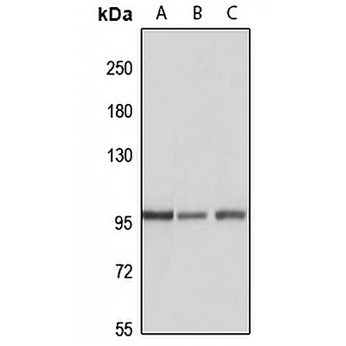 HACE1 Rabbit Polyclonal Antibody