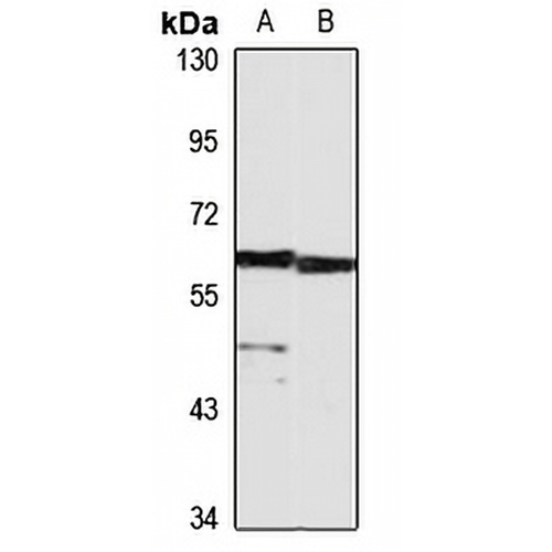 HAS1 Rabbit Polyclonal Antibody
