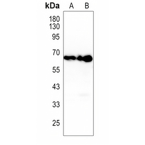 HAS2 Rabbit Polyclonal Antibody