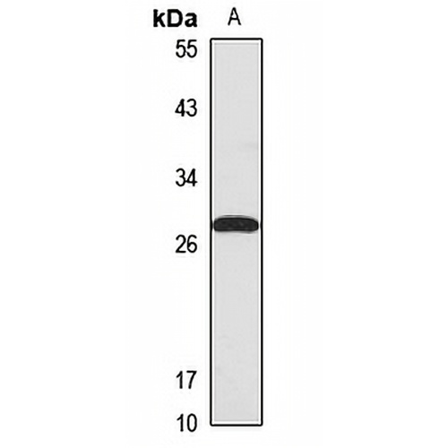CEP27 Rabbit Polyclonal Antibody