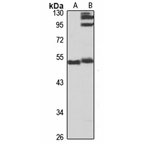 HICE1 Rabbit Polyclonal Antibody