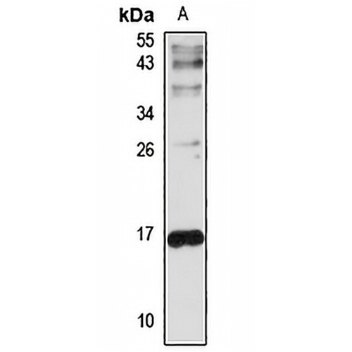 Hemoglobin beta Rabbit Polyclonal Antibody