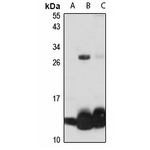 Hemoglobin beta Rabbit Polyclonal Antibody
