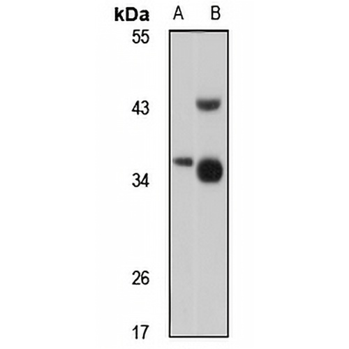 HEY1 Rabbit Polyclonal Antibody