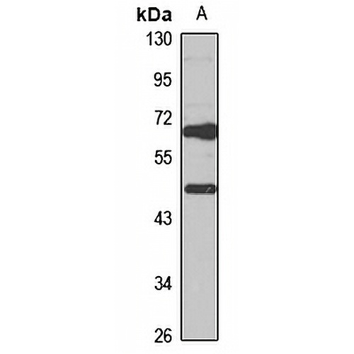 HGD Rabbit Polyclonal Antibody