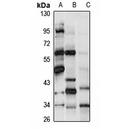 HHAT Rabbit Polyclonal Antibody