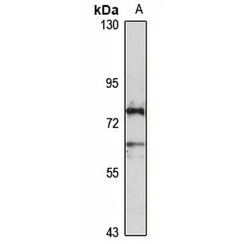 HHIP Rabbit Polyclonal Antibody