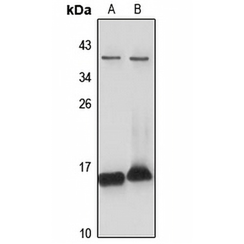 HIGD1A Rabbit Polyclonal Antibody