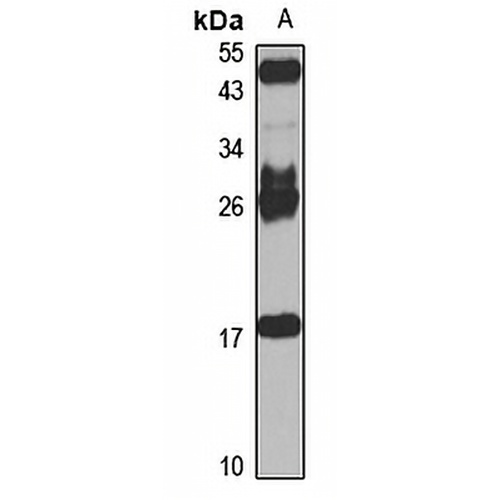 HLA-DMB Rabbit Polyclonal Antibody
