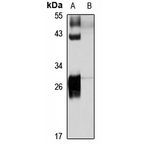 HLA-DRB4 Rabbit Polyclonal Antibody
