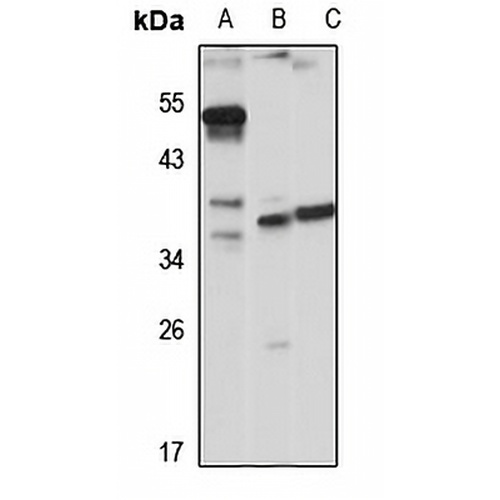 HLA-DRB5 Rabbit Polyclonal Antibody
