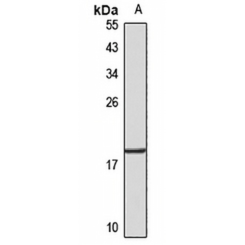 HMGA2 Rabbit Polyclonal Antibody