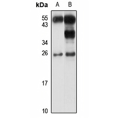 HMGB3 Rabbit Polyclonal Antibody