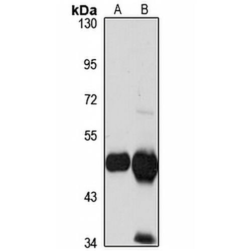 HMGCS2 Rabbit Polyclonal Antibody