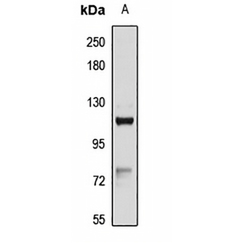 HMHA1 Rabbit Polyclonal Antibody
