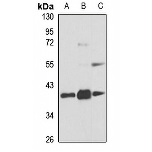 hnRNP D Rabbit Polyclonal Antibody