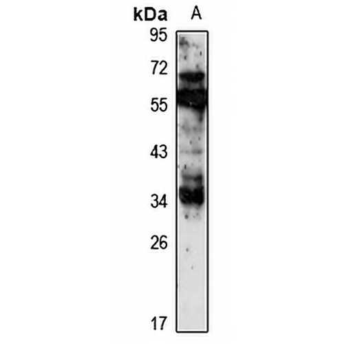 HOXC11 Rabbit Polyclonal Antibody