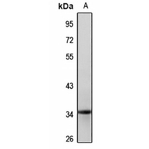 HOXC13 Rabbit Polyclonal Antibody