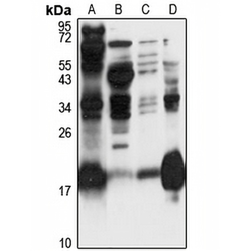 HPCAL4 Rabbit Polyclonal Antibody