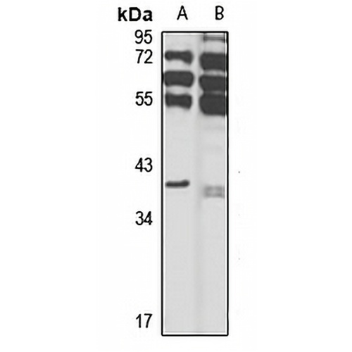 HPR Rabbit Polyclonal Antibody
