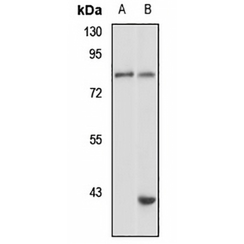 HPS-4 Rabbit Polyclonal Antibody