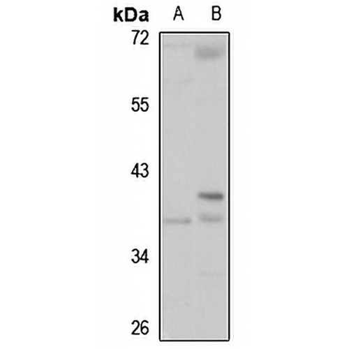 HSD17B1 Rabbit Polyclonal Antibody