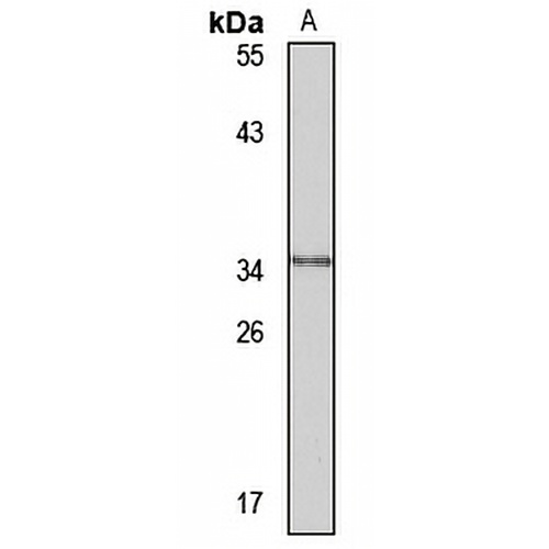 HSD17B12 Rabbit Polyclonal Antibody