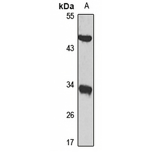 HSD17B3 Rabbit Polyclonal Antibody