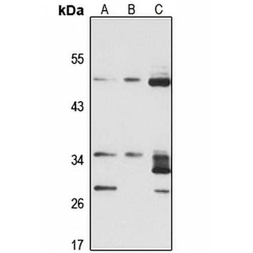 HSD17B6 Rabbit Polyclonal Antibody