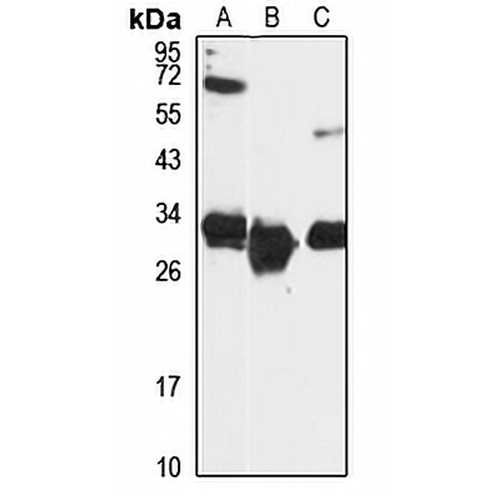 HSD17B8 Rabbit Polyclonal Antibody