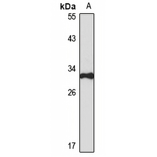 TIP30 Rabbit Polyclonal Antibody