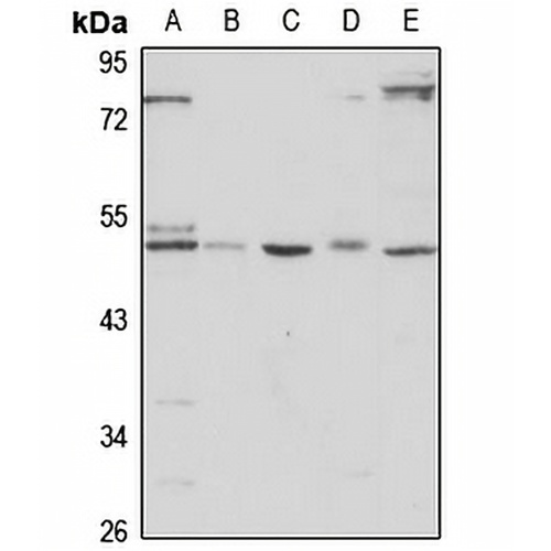 HTRA3 Rabbit Polyclonal Antibody