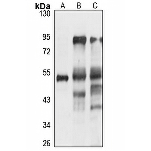 HTRA4 Rabbit Polyclonal Antibody