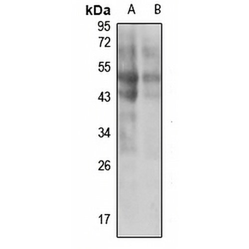 HYAL2 Rabbit Polyclonal Antibody