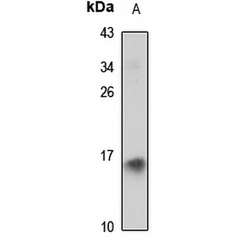 ID2 Rabbit Polyclonal Antibody