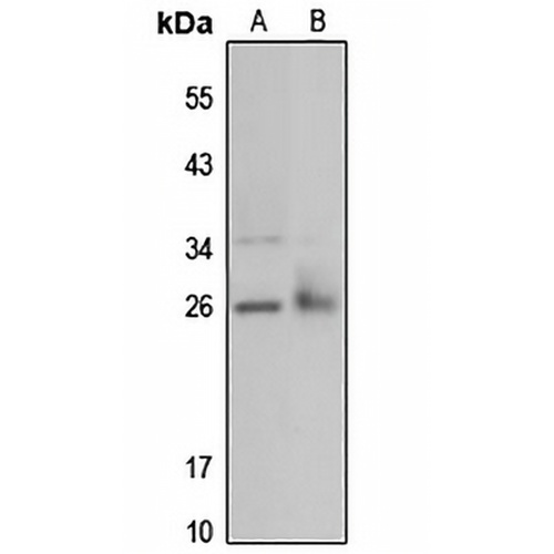 IDI1 Rabbit Polyclonal Antibody