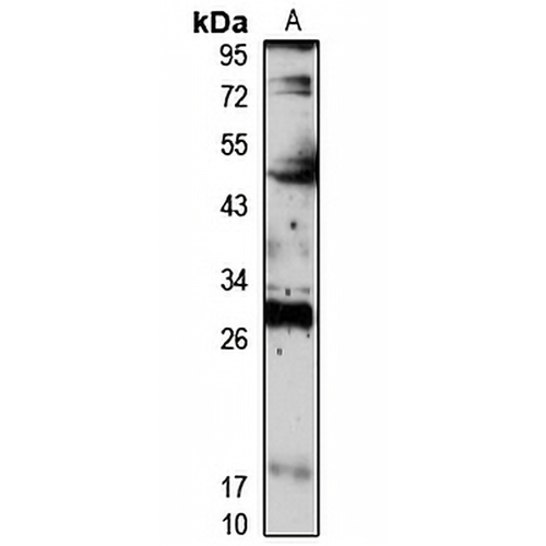 IDI2 Rabbit Polyclonal Antibody