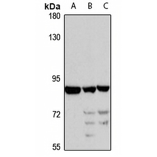 IFT81 Rabbit Polyclonal Antibody