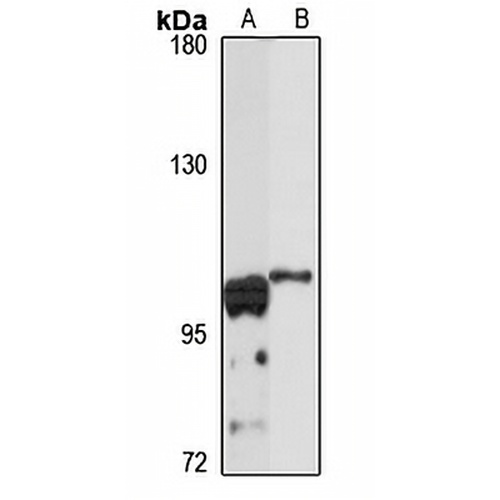 IFT88 Rabbit Polyclonal Antibody