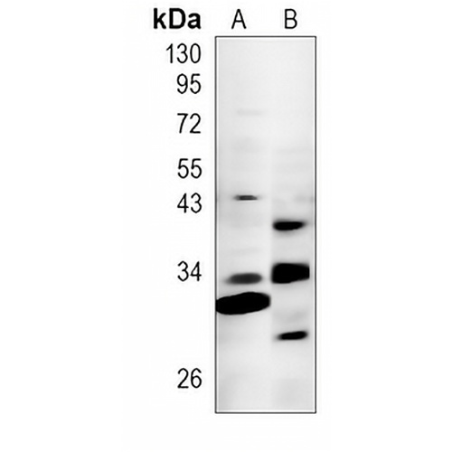 IGFBP6 Rabbit Polyclonal Antibody