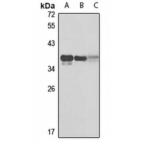 IGFBP7 Rabbit Polyclonal Antibody